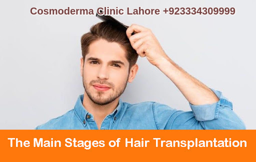 Hair transplantation