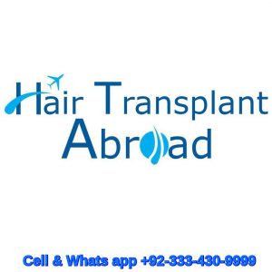 hair transplant in Nairobi Kenya