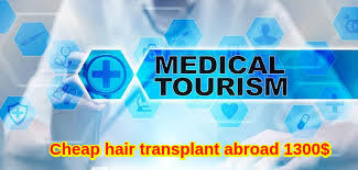 Cheap hair transplant in Perth Australia