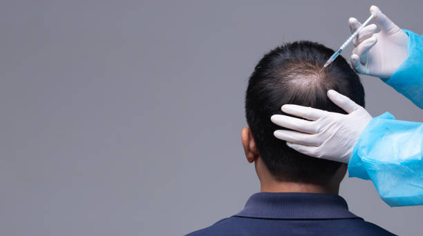Hair loss treatment USA