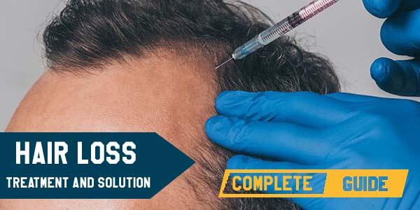 hair loss treatment