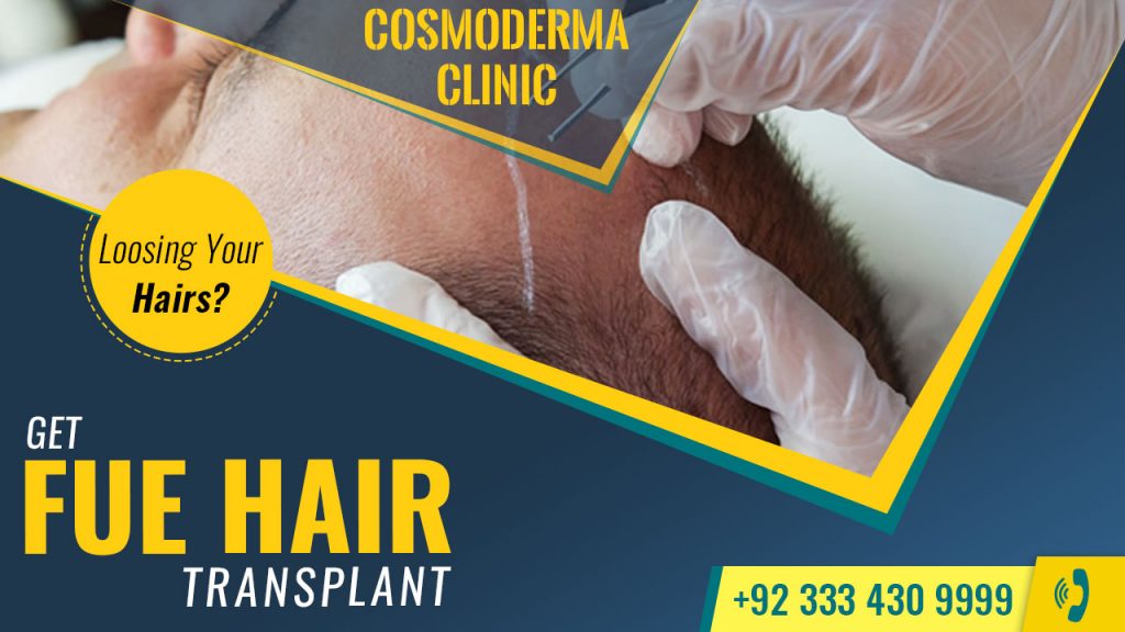 Fue hair transplant Lahore