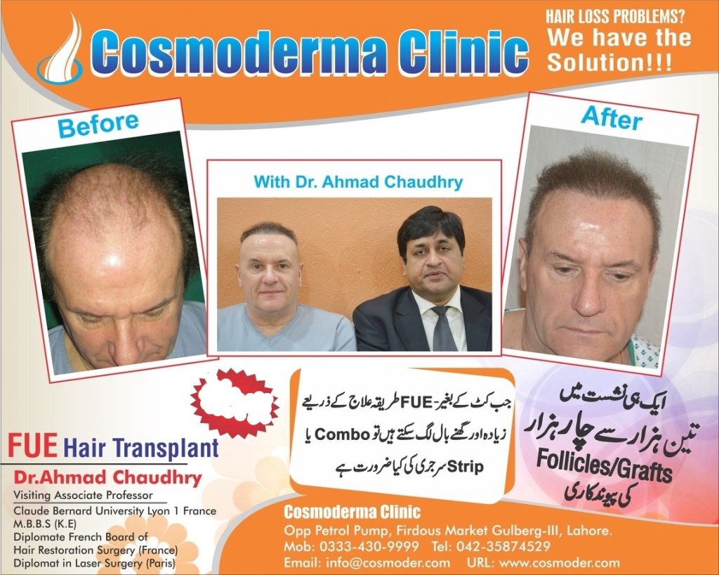 Hair transplant clinic Lahore