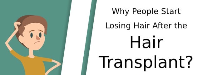 Losing transplanted hair