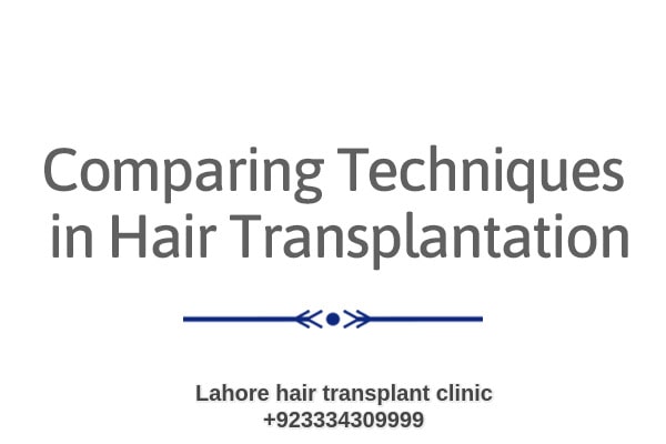 Hair Transplant Technique Overview