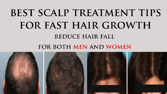 Scalp treatment for hair fall