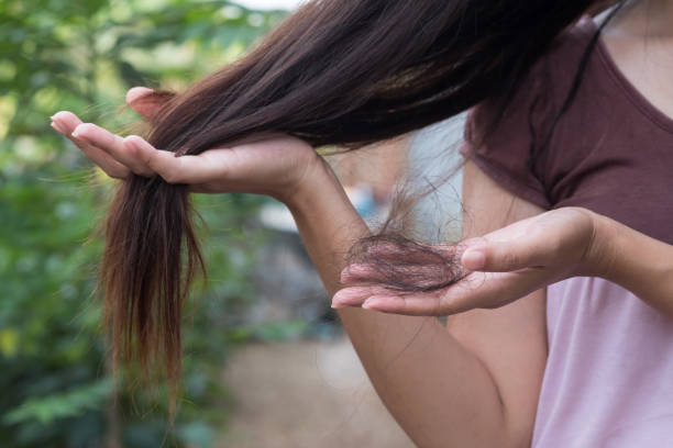 woman hair shedding