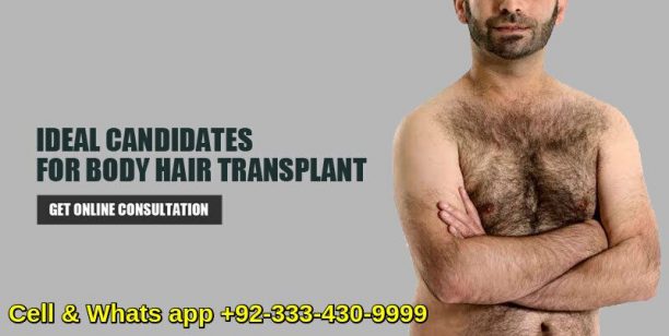 body hair transplant